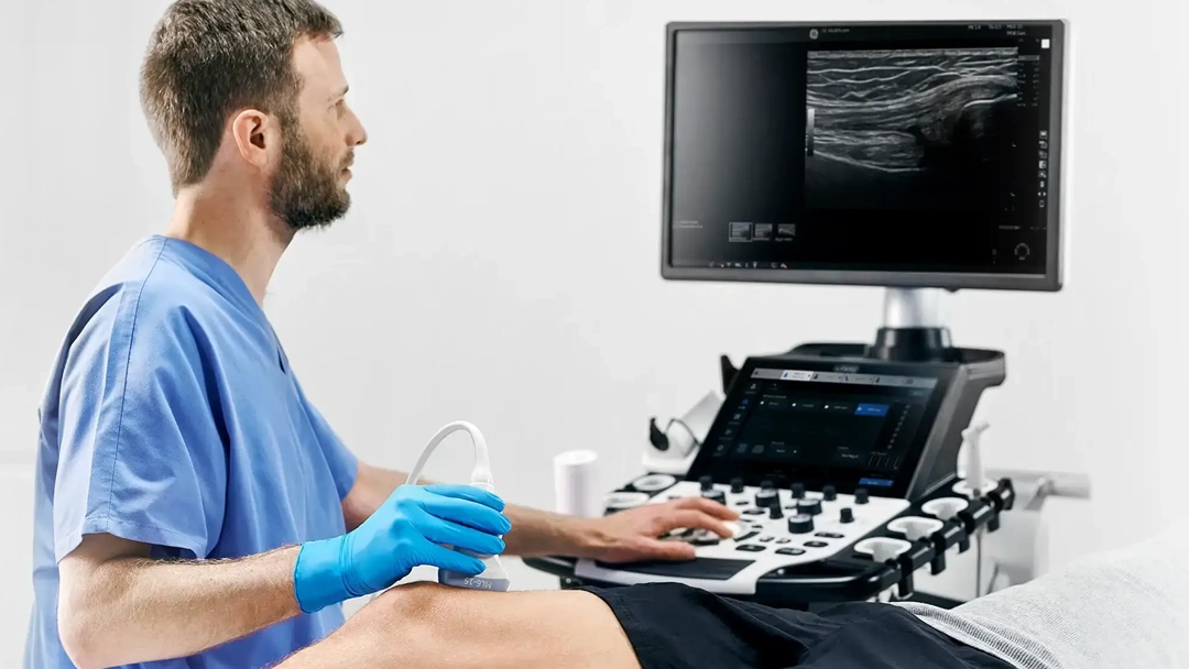 Cuerpo Calloso Fetal