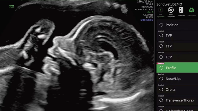 Ecografía del segundo trimestre: qué funciones realmente ahorran tiempo en la práctica diaria
