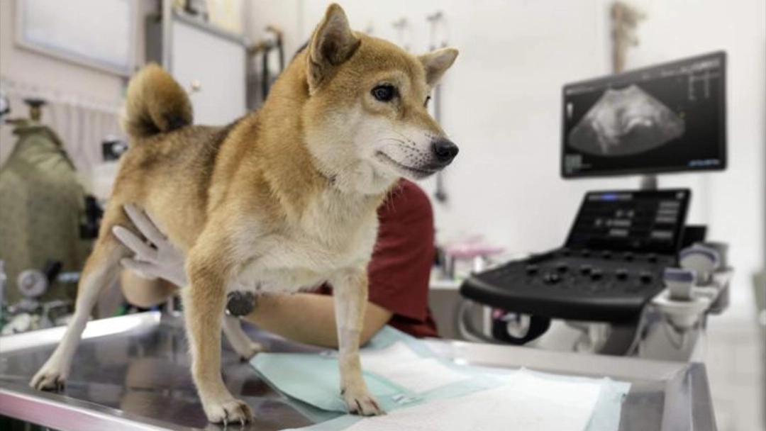 Cuerpo Calloso Fetal