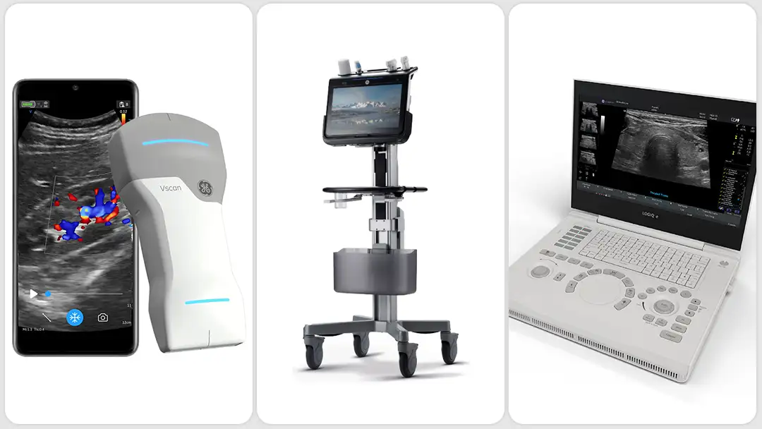 Cuerpo Calloso Fetal