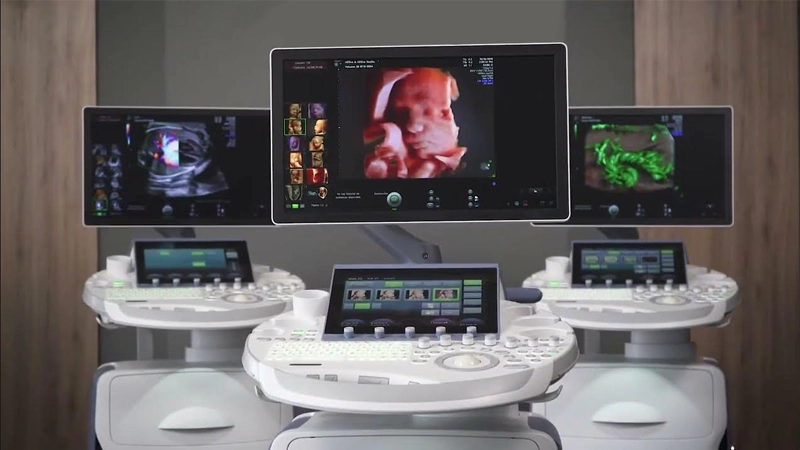 Guía para elegir un ecógrafo gineco-obstétrico según el tipo de consulta