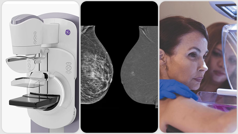 Mamografía 2D, Tomosíntesis, Ultrasonido ABUS y Mamografía Contrastada: ¿cuándo usar cada tecnología?