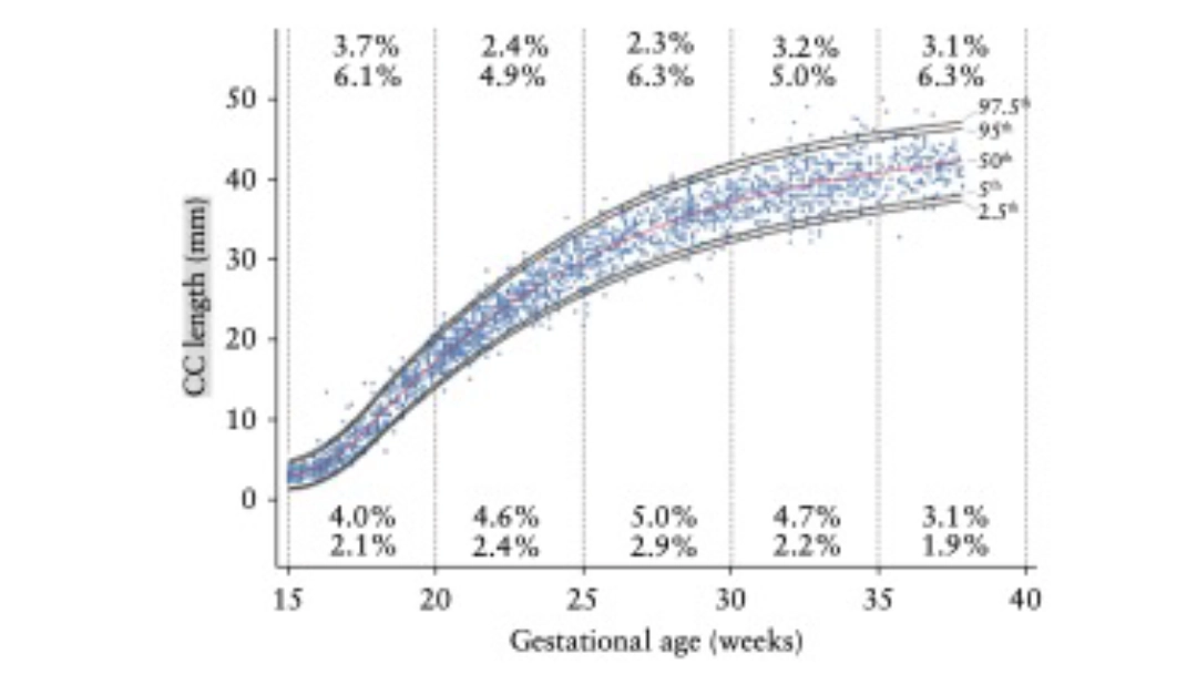 Plano Sagital Ecografia Transvaginal